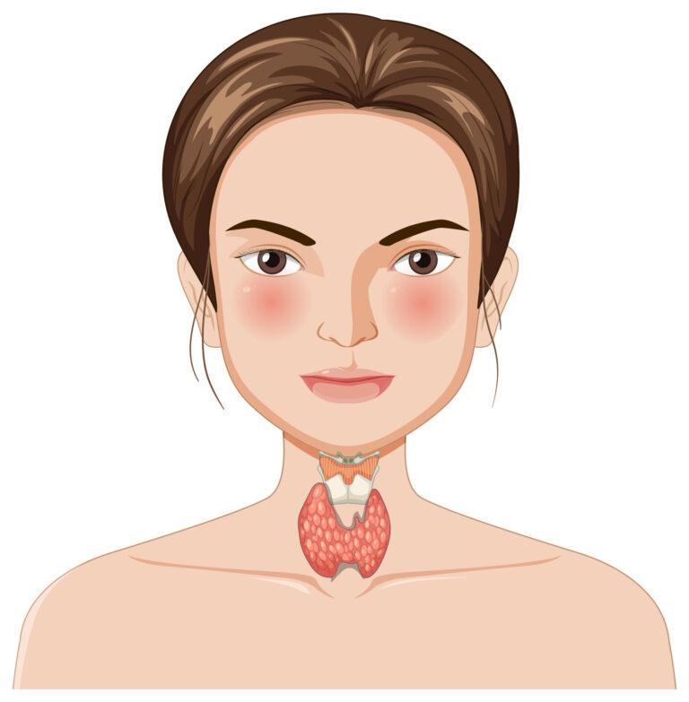 Thyroid Nodule Treatment in Hyderabad